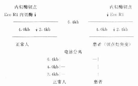 临床生物化学\/核酸限制性片段长度多态性(RFL